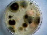 microbiologyfungi1